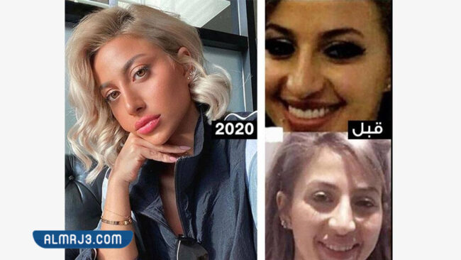 مودل روز قبل وبعد