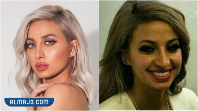 مودل روز قبل وبعد