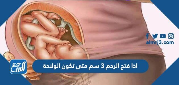 اذا فتح الرحم 3 سم متى تكون الولادة