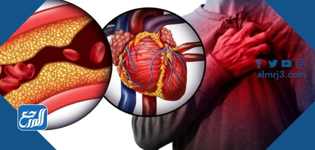 اضرار الكوليسترول