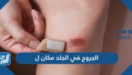 الجروح في الجلد مكان ل