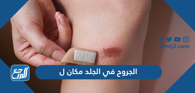 الجروح في الجلد مكان ل