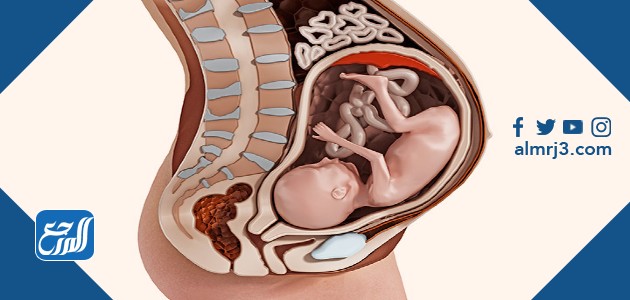 السدادة المخاطية