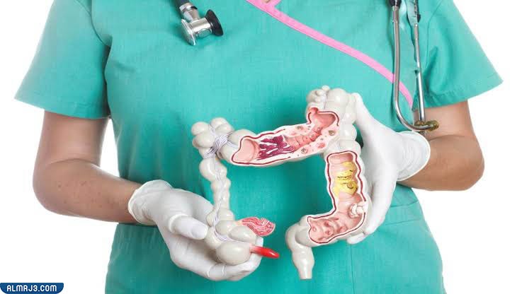 الفرق بين القولون العصبي والهضمي 1