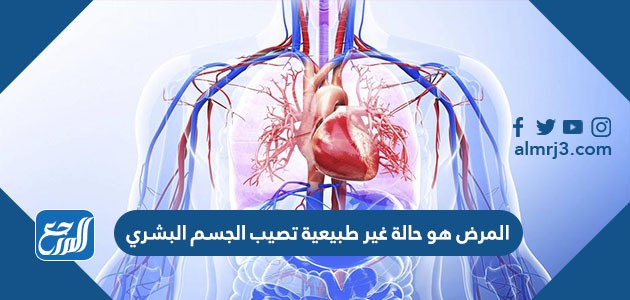 المرض هو حالة غير طبيعية تصيب الجسم البشري