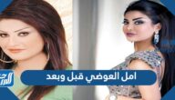 امل العوضي قبل وبعد