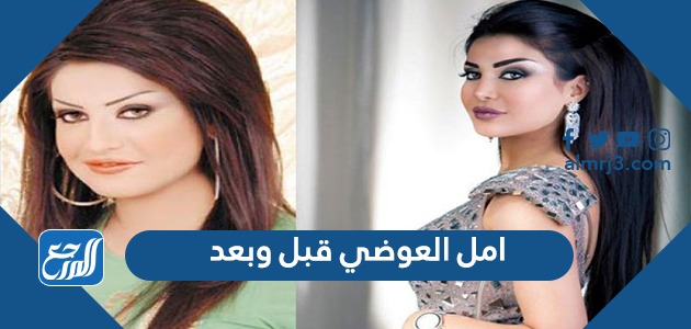 امل العوضي قبل وبعد