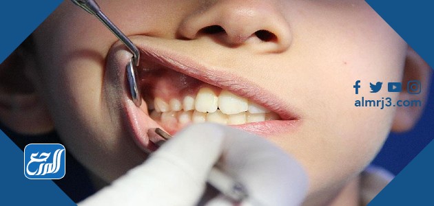 انحسار اللثة