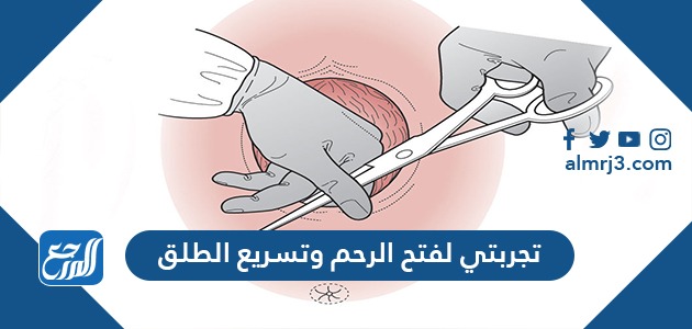 تجربتي لفتح الرحم وتسريع الطلق