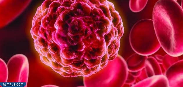 تجربتي مع نقص الصفائح الدموية