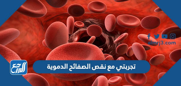 تجربتي مع نقص الصفائح الدموية