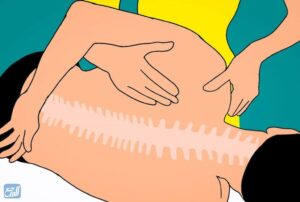 تشخيص ألم العصعص