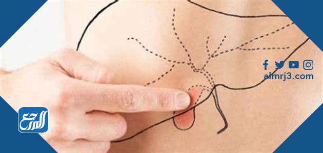 تكلفة عملية المرارة في السعودي الألماني