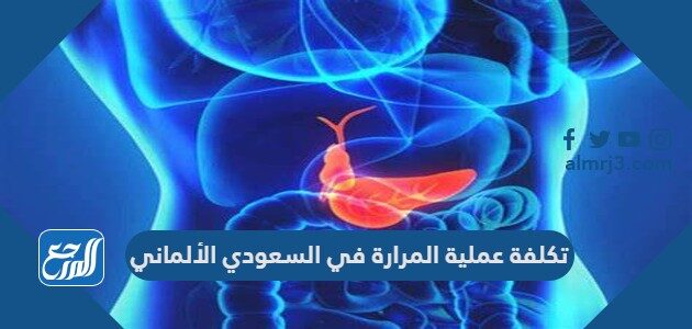 تكلفة عملية المرارة في السعودي الألماني
