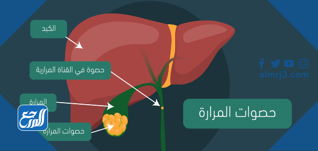 تكلفة عملية المرارة في السعودي الألماني