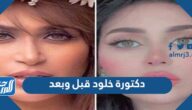 دكتورة خلود قبل وبعد
