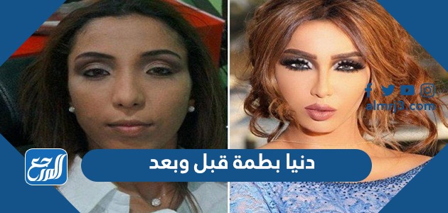 دنيا بطمة قبل وبعد