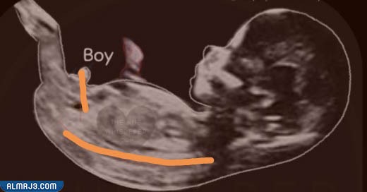 سونار الولد في الشهر الثالث