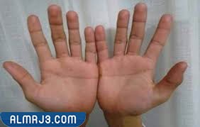 صفات الإنسان الزهري بالصور