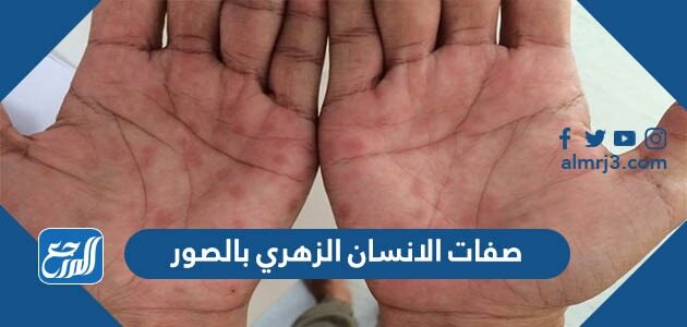 صفات الانسان الزهري بالصور