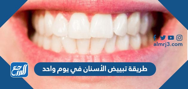 طريقة تبييض الأسنان في يوم واحد