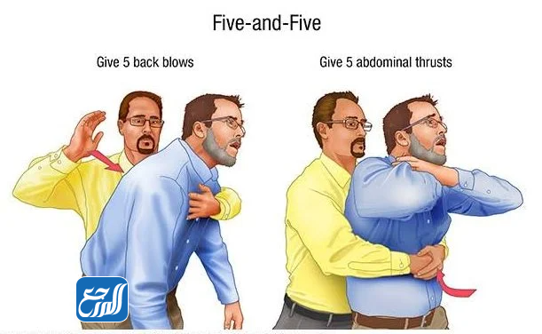 أسباب الشرقة أثناء النوم 