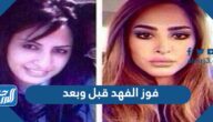 فوز الفهد قبل وبعد 