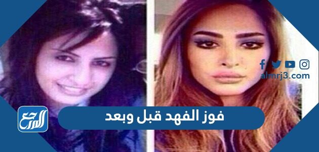 فوز الفهد قبل وبعد