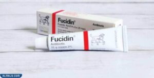 كريم فيوسيدين