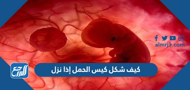 كيف شكل كيس الحمل إذا نزل
