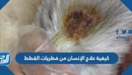 كيفية علاج الإنسان من فطريات القطط
