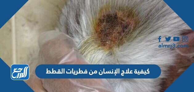 كيفية علاج الإنسان من فطريات القطط