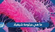 ما هي جرثومة شيغيلا