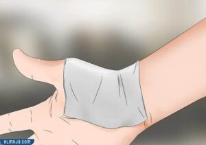 وضع قطعة من القماش النظيفة والباردة على الحروق الشديدة