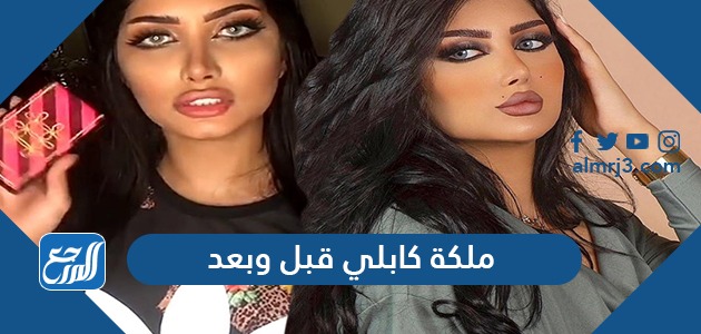 ملكة كابلي قبل وبعد