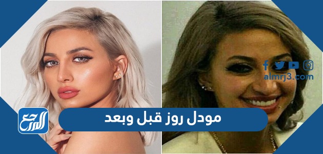 مودل روز قبل وبعد