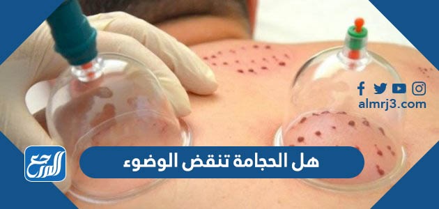 هل الحجامة تنقض الوضوء