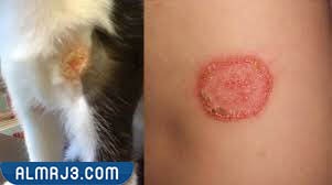 أعراض فطريات القطط على الإنسان