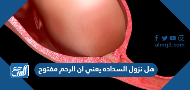 هل نزول السداده يعني ان الرحم مفتوح