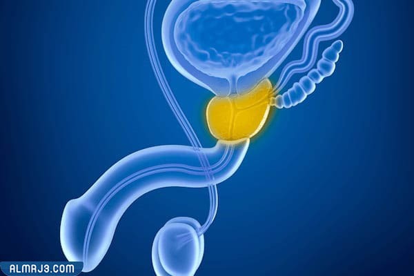 هل يزول احتقان البروستاتا بدون علاج