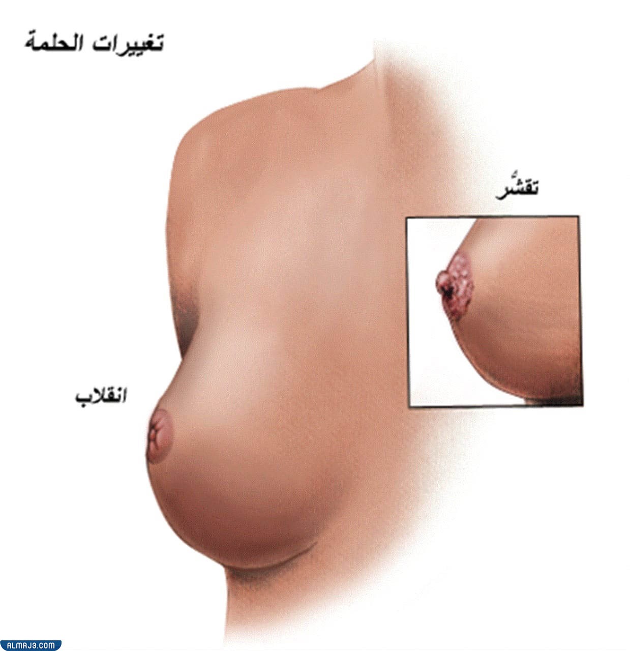 هل انكماش وانقلاب الحلمتين من أعراض الحمل
