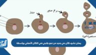 يمكن نشوء كائن حي جديد من نمو جانبي في الكائن الأصلي بواسطة ……………