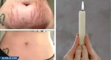 Fourth, remove the white lines from the body by means of a light candle
