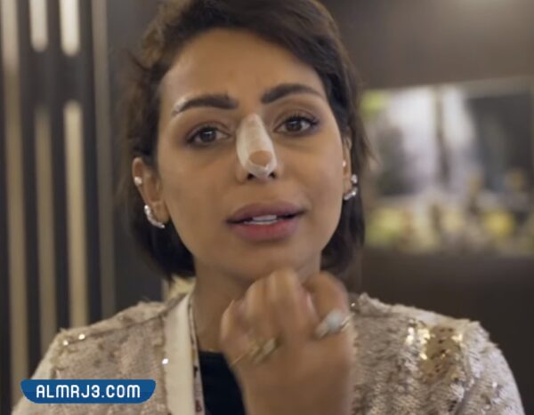 هند البلوشي بعد عمليات التجميل