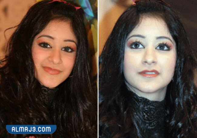 أسيل عمران قبل التجميل