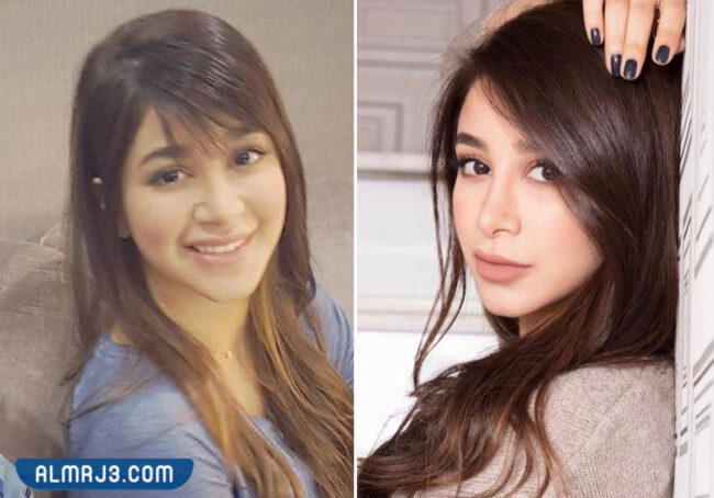 اسيل عمران قبل وبعد