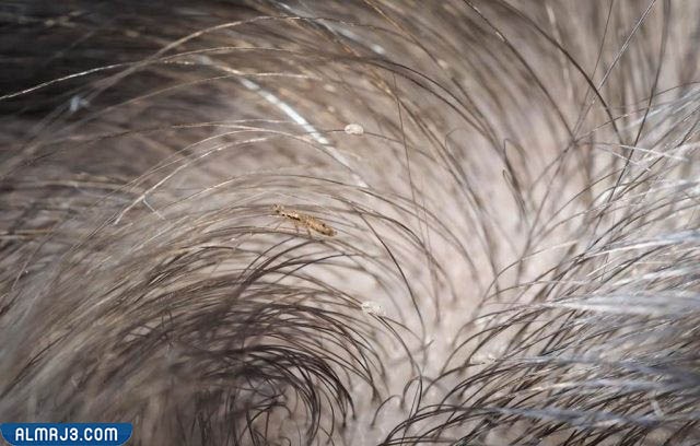 التعريف بالقمل