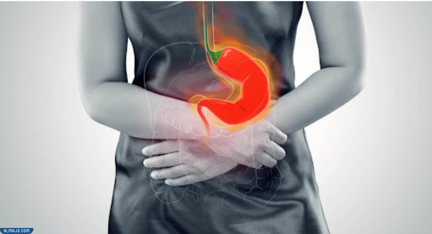 اسباب حرقة المعدة بعد الرياضة