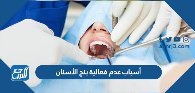 أسباب عدم فعالية بنج الأسنان