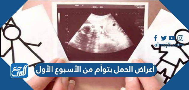 أعراض الحمل بتوأم من الأسبوع الأول